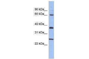 HORMAD2 antibody used at 1 ug/ml to detect target protein. (HORMAD2 antibody  (Middle Region))