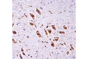 PAK3 antibody immunohistochemistry analysis in formalin fixed and paraffin embedded mouse brain tissue. (PAK3 antibody  (AA 124-152))