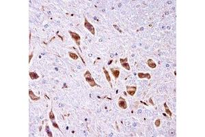 PAK3 antibody immunohistochemistry analysis in formalin fixed and paraffin embedded mouse brain tissue. (PAK3 antibody  (AA 124-152))