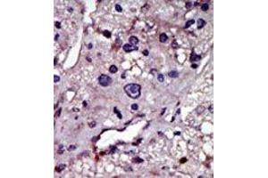 Image no. 1 for anti-Cytidine Monophosphate (UMP-CMP) Kinase 1, Cytosolic (CMPK1) (N-Term) antibody (ABIN360613) (Cytidine Monophosphate (UMP-CMP) Kinase 1, Cytosolic (CMPK1) (N-Term) antibody)