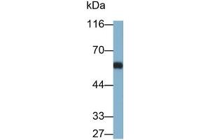Detection of OCTN1 in Rat Thymus lysate using Polyclonal Antibody to Organic Cation/Ergothioneine Transporter (OCTN1)