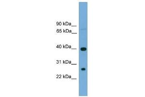 TREML2 antibody used at 0. (TREML2 antibody  (N-Term))