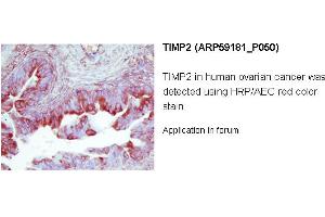 Image no. 2 for anti-Metalloproteinase Inhibitor 2 (TIMP2) (Middle Region) antibody (ABIN2787968) (TIMP2 antibody  (Middle Region))