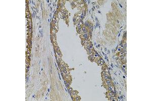 Immunohistochemistry of paraffin-embedded human prostate using PIK3C3 antibody (ABIN2737377) at dilution of 1:100 (40x lens).