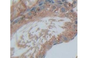 Figure. (SAT1 antibody  (AA 1-171))