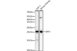 Western blot analysis of extracts of various cell lines, using GPX1 Rabbit mAb (ABIN7267434) at 1:12000 dilution. (Glutathione Peroxidase 1 antibody)