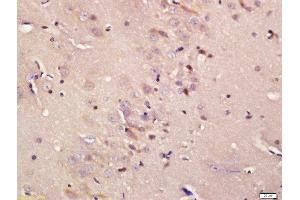 Formalin-fixed and paraffin embedded rat brain labeled with Rabbit Anti-ADCY5 Polyclonal Antibody, Unconjugated  at 1:200 followed by conjugation to the secondary antibody and DAB staining (ADCY5 antibody  (AA 857-909))