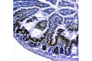 IHC analysis of Bcl-2 using anti-Bcl-2 antibody . (Bcl-2 antibody  (AA 118-165))
