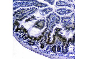 IHC analysis of Bcl-2 using anti-Bcl-2 antibody .