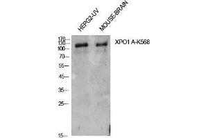 Western Blot (WB) analysis of HepG2-UV, Mouse Brain cells using Acetyl-CRM1 (K568) Polyclonal Antibody.