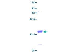 MT1H Protein (AA 1-61) (GST tag)