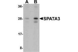 Western blot analysis of SPATA3 in mouse lung tissue lysate with SPATA3 Antibody  at (A) 1 and (B) 2 ug/mL. (SPATA3 antibody  (C-Term))