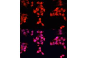 Immunofluorescence analysis of HeLa cells using ENO3 antibody (ABIN7266960) at dilution of 1:100. (ENO3 antibody  (AA 1-190))