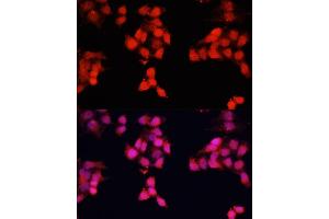 Immunofluorescence analysis of HeLa cells using ENO3 antibody (ABIN7266960) at dilution of 1:100.