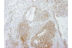 Immunohistochemistry (IHC) image for anti-Protein Arginine Methyltransferase 5 (PRMT5) (C-Term) antibody (ABIN7448743) (PRMT5 antibody  (C-Term))