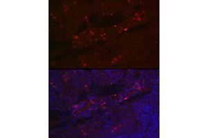 Immunofluorescence analysis of rat spleen cells using CD25 Rabbit pAb (ABIN3017118, ABIN3017119, ABIN3017120 and ABIN6219963) at dilution of 1:100 (40x lens). (CD25 antibody)