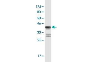 Western Blot detection against Immunogen (36. (SEMA6B antibody  (AA 28-126))
