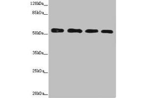 Western blot All lanes: CALCOCO2 antibody at 3.