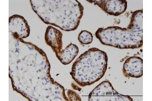 Image no. 1 for anti-Lanosterol Synthase (2,3-Oxidosqualene-Lanosterol Cyclase) (LSS) (AA 633-733) antibody (ABIN599396) (LSS antibody  (AA 633-733))