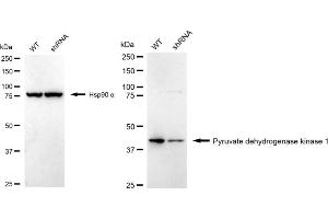 Western blotting analysis using Pyruvate dehydrogenase kinsae 1 antibody (ABIN7800082).