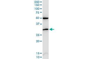 CDKN1B monoclonal antibody (M02), clone 2F4. (CDKN1B antibody  (AA 100-198))