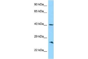 WB Suggested Anti-ABI1 Antibody Titration: 1. (ABI1 antibody  (C-Term))