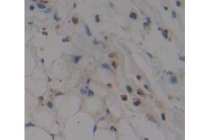 Figure. (ZNRD1 antibody  (AA 1-126))