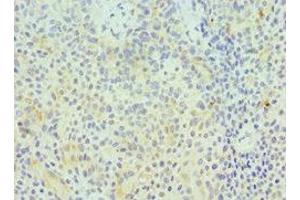 Immunohistochemistry (IHC) image for anti-Granzyme A (Granzyme 1, Cytotoxic T-Lymphocyte-Associated serine Esterase 3) (GZMA) (AA 29-262) antibody (ABIN7154414)