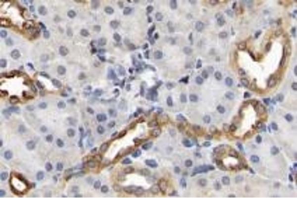 CLDN10 antibody