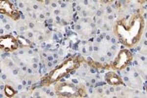 Immunohistochemistry analysis of paraffin-embedded rat kidney using,Claudin 10 (ABIN7073514) at dilution of 1: 2000 (CLDN10 antibody)