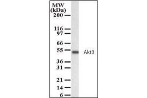Western blot analysis for AKT3 using antibody at 2 µg/ml dilution against 15 µg/lane of HeLa cell lysate. (AKT3 antibody  (AA 119-136))