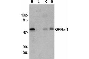 Image no. 2 for anti-GDNF Family Receptor alpha 1 (GFRA1) (AA 369-382) antibody (ABIN201472) (GFRA1 antibody  (AA 369-382))