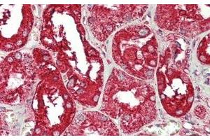 Immunohistochemistry (IHC) image for anti-Annexin A4 (ANXA4) (AA 11-164) antibody (ABIN7435871)