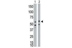 Image no. 1 for anti-Bone Morphogenetic Protein Receptor 1A (BMPR1A) (Middle Region) antibody (ABIN357375) (BMPR1A antibody  (Middle Region))