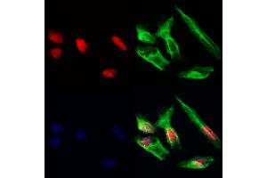 HDGFRP3 Antibody staining Hela cells by IF/ICC.