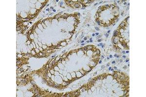 Immunohistochemistry of paraffin-embedded Human stomach using SIGMAR1 Polyclonal Antibody (SIGMAR1 antibody)