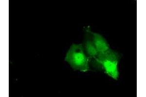 Anti-KHK mouse monoclonal antibody (ABIN2453198) immunofluorescent staining of COS7 cells transiently transfected by pCMV6-ENTRY KHK (RC202424). (Ketohexokinase antibody)