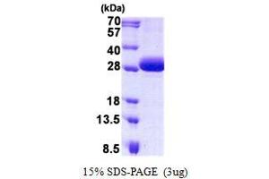 Image no. 1 for DiGeorge Syndrome Critical Region Gene 6 (DGCR6) protein (His tag) (ABIN1098553)