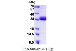 Image no. 1 for DiGeorge Syndrome Critical Region Gene 6 (DGCR6) protein (His tag) (ABIN1098553) (DGCR6 Protein (His tag))