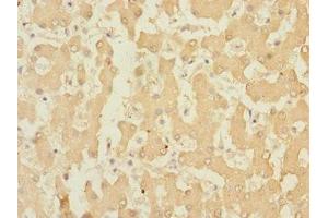 Immunohistochemistry of paraffin-embedded human liver tissue using ABIN7167108 at dilution of 1:100 (RAPGEF4 antibody  (AA 1-210))