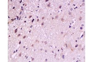Formalin-fixed and paraffin embedded: rat brain tissue labeled with Anti-TrkB Polyclonal Antibody, Unconjugated  at 1:200, followed by conjugation to the secondary antibody and DAB staining (TRKB antibody  (AA 32-120))
