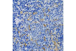 Immunohistochemistry of paraffin-embedded rat spleen using IQG antibody (ABIN7268020) at dilution of 1:200 (40x lens). (IQGAP1 antibody  (AA 500-750))