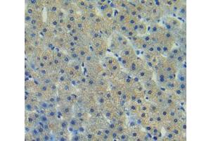 Used in DAB staining on fromalin fixed paraffin- embedded liver tissue (FAK antibody  (AA 798-1041))