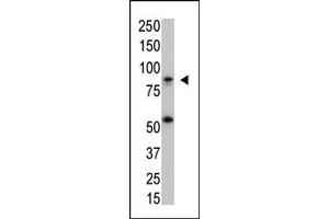 The anti-IKKbeta Mab (ABIN1882049 and ABIN2843911) is used in Western blot to detect IKKbeta in SK-BR3 cell lysate. (IKBKB antibody)