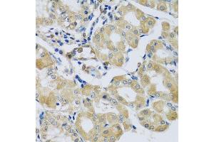 Immunohistochemistry of paraffin-embedded human stomach using SYT11 antibody. (SYT11 antibody  (AA 37-200))