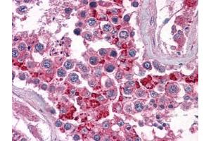 Human Testis: Formalin-Fixed, Paraffin-Embedded (FFPE) (BIRC3 antibody)