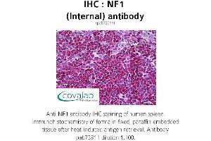 Image no. 2 for anti-Neurofibromin 1 (NF1) (Internal Region) antibody (ABIN1737327) (Neurofibromin 1 antibody  (Internal Region))