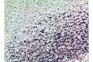 Immunohistochemical analysis of paraffin-embedded human-brain, antibody was diluted at 1:200 (DROSHA antibody  (Internal Region))