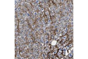 Immunohistochemical staining (Formalin-fixed paraffin-embedded sections) of human liver with GPR124 polyclonal antibody  shows strong membranous positivity in hepatocytes at 1:20-1:50 dilution. (GPR124 antibody)
