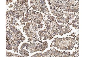 IHC analysis of TAB2 using anti-TAB2 antibody (ABIN7600244). (TAB2 antibody  (AA 169-522))